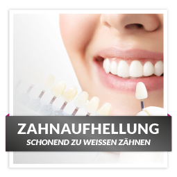 HofBeauty_kosmetische-Zahnaufhellung