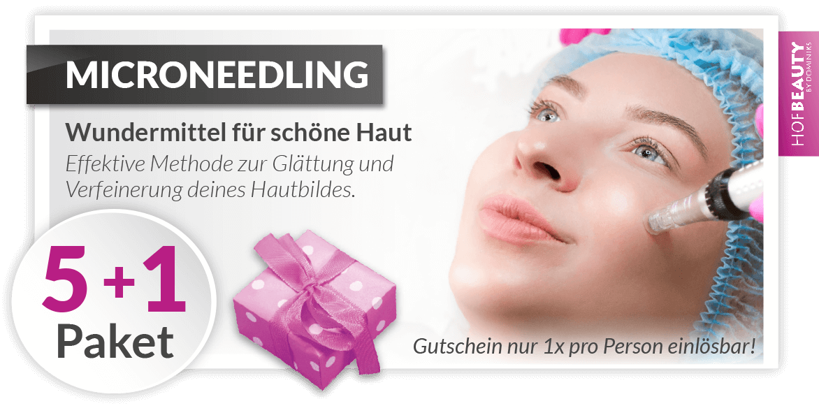 HofBeauty-Gutschein-Microneedling-Rabatt-Paket